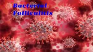 Folliculitis 