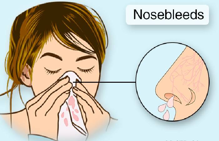 prevent of nosebleed