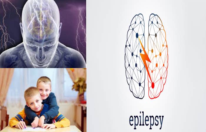 epilepsy