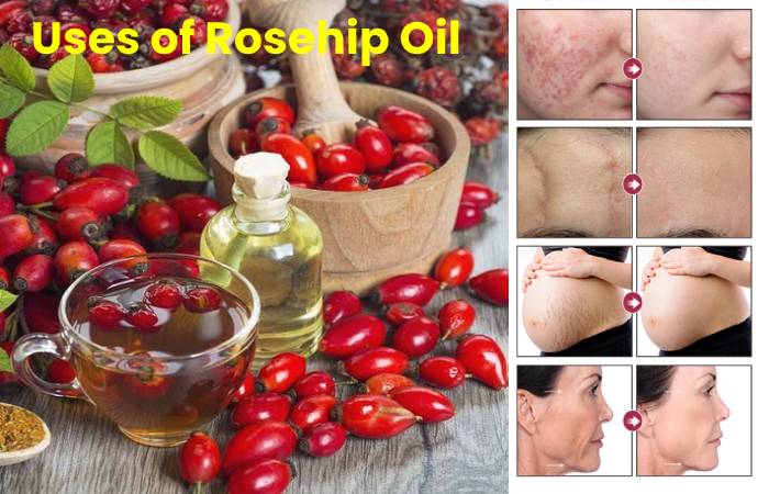 rosehip oil