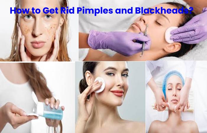 Pimples and Blackheads