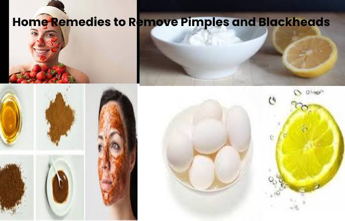 Pimples and Blackheads