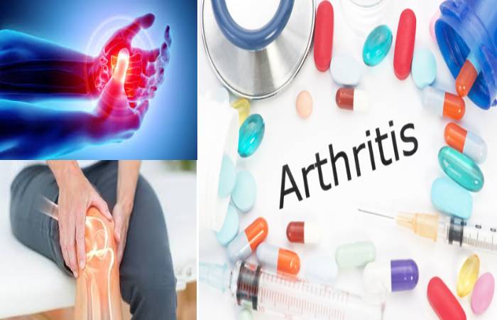 arthritis