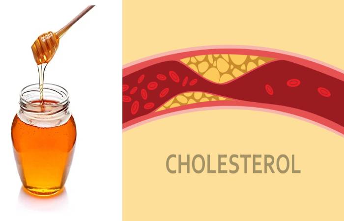 Cholesterol