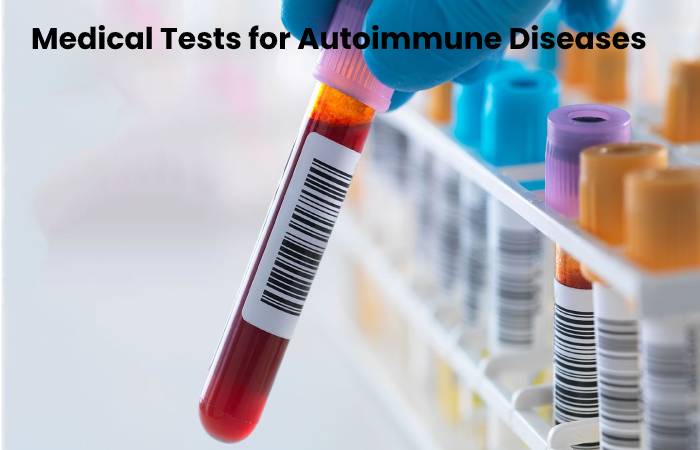 Autoimmune Diseases