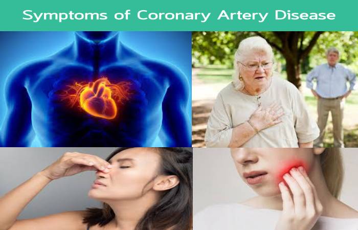 coronary artery disease