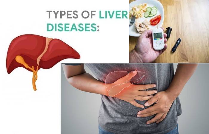 liver disease