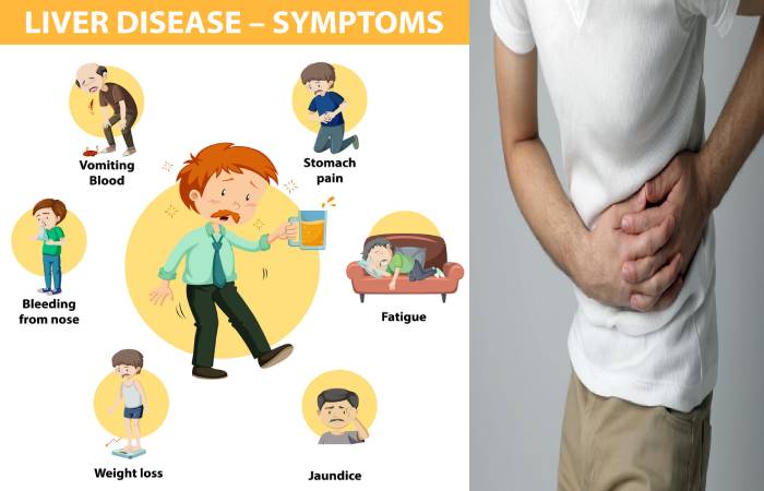 liver disease