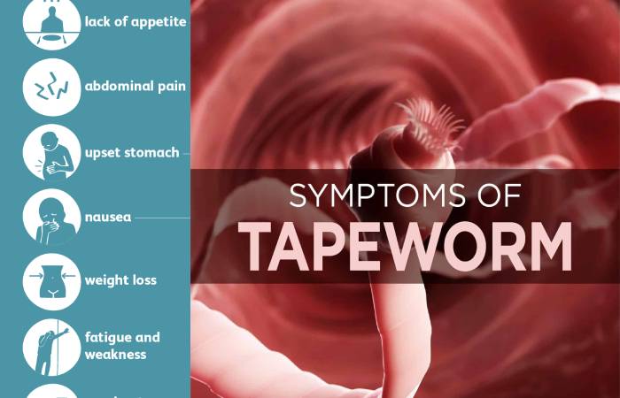 tapeworm infection