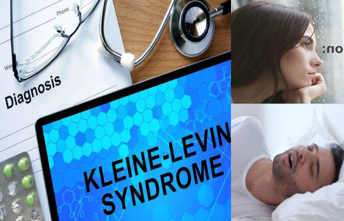 Kleine-Levin Syndrome