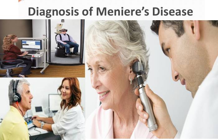 meniere's disease