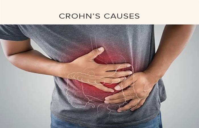 crohn's disease