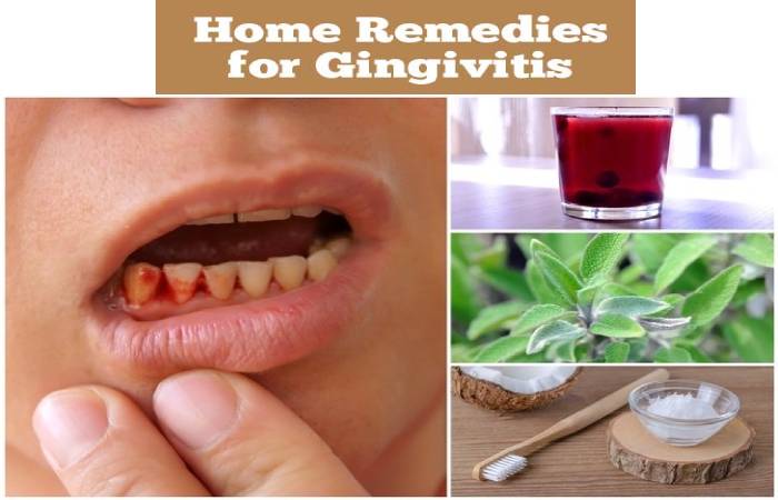 gingivitis