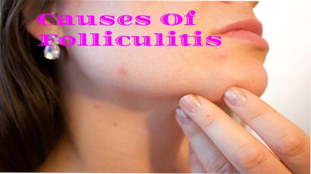 Folliculitis What Is Folliculitis Its Symptoms Causes And More 